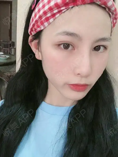 一组化妆前vs化妆后的照片,还好吧,最近皮肤状态比较...垫鼻尖悦美整形

