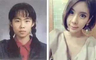 韩国人整形范例,整到最后每张脸都好像
