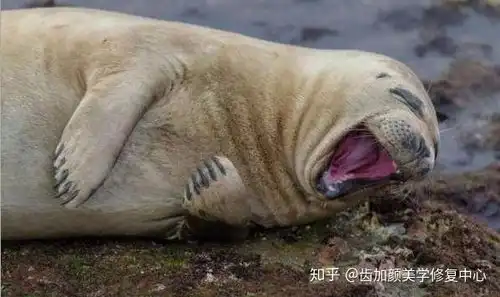 大揭秘为啥漂亮妹子总是笑不露齿齿加颜
