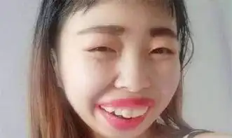她因扮丑而走红网络,粉丝迅速涨千万,如今真实容貌让网友吐槽
