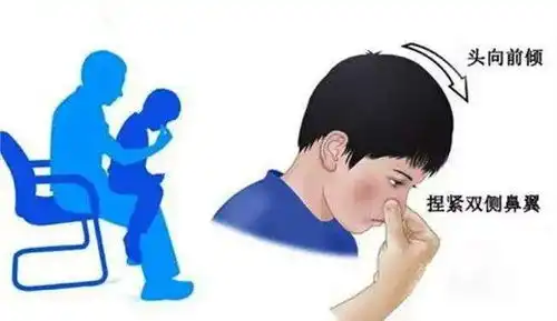 鼻子出血了,千万不要仰头冷知识bot
