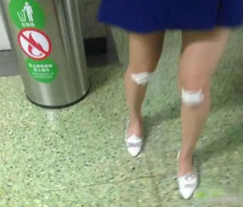 搞笑内涵段子美女内涵图集合,妹子的腿是怎么啦
