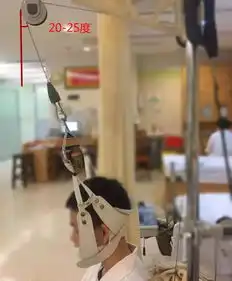 这种上吊式锻炼方式是颈椎牵引搞不好会没命
