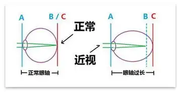 网红眼药水真相效果是暂时的,坏处是长久的
