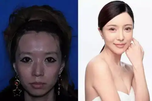 19名女子公布整容前后照片,看完太惊艳
