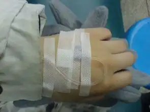 寻找一张在住院躺在床上照片
