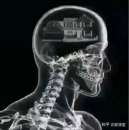 爆笑图片经常头痛,去检查医生说是想的太多
