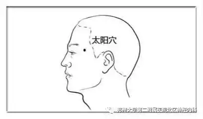 缓解头痛的五大穴位
