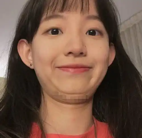 咬肌大的女生该怎么办其实这3动作就能自救,让你轻松变小v脸
