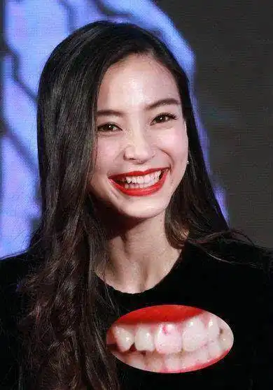 明星脱妆瞬间,赵丽颖油光满面,热巴变熊猫眼,陈乔恩最尴尬
