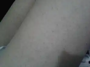 我的腿不知道怎么了,出现很多小红豆豆,如图一样