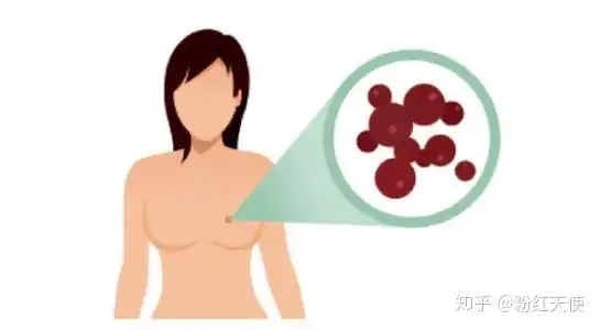 粉红天使你不看就不知道的关于乳房的冷知识
