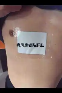 老倪膏药各部位症状及的贴敷方法
