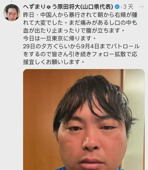 中国游客因踢鹿被日本人狂骂,一直笑着说sorry日本网友却这样说...
