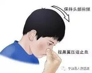 鼻子出血别慌张,专家支招好预防