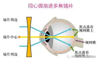 暑假来啦孩子们的双眼还好吗
