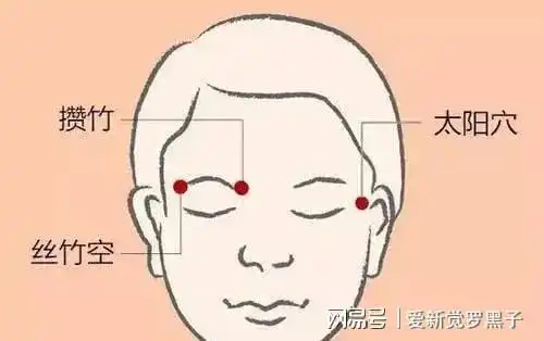 丝竹空穴又称头痛穴,中医有言偏正头风痛难医,丝竹金针亦可施
