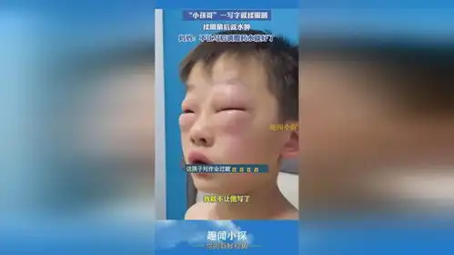 小孩哥一写字就揉眼睛,揉眼睛后就水肿妈妈滴眼药水就好多了,可能是细菌感染
