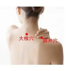 用按摩的方法来治疗落枕

