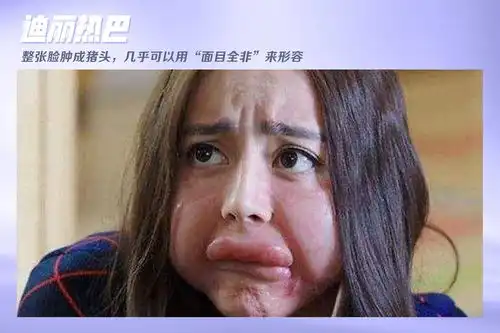 刘昊然秃头倪妮龅牙演员扮丑赛道哪家强
