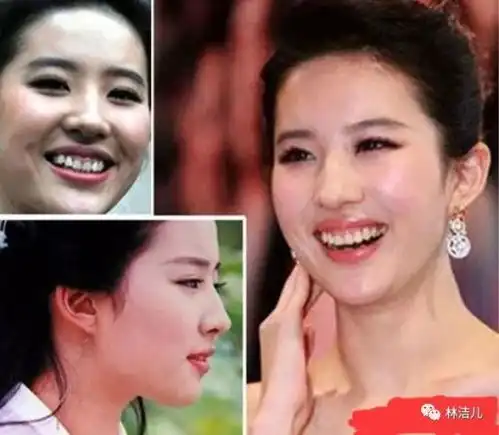 微笑是仙女,大笑变丑女,杨幂刘亦菲颜值出问题都是因为这个bug
