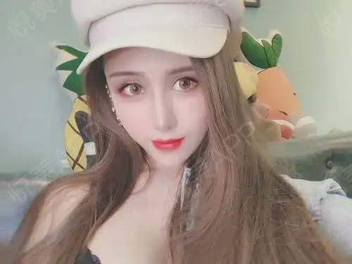 总有人问我隆鼻以后可以做表情吗,敢做吗,做了表情会...垫鼻尖悦美整形
