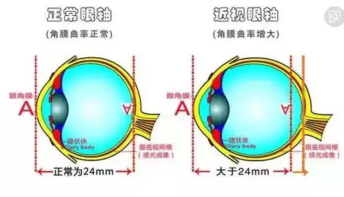 造成近视的因素东盛堂告诉您
