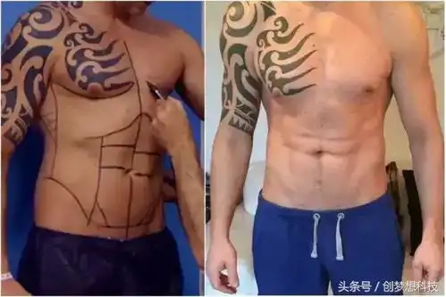 英国奇葩男子为拥有完美腹肌花费3.3万元手术,手术后哭了
