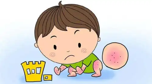 湿疹太恼人,做好这5点就能预防,很简单直接照做
