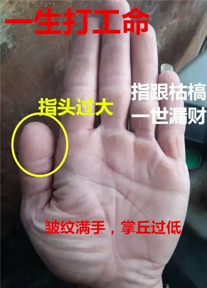 这里太粗大,皱纹遍布,极伤财运,一生注定是打工命,难有财
