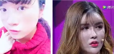 丑女整容为报复前男友,整容前照片令男生崩溃,网友干的漂亮
