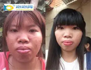 星热点越南女郭金凤整容前后照片整容嫁富二代