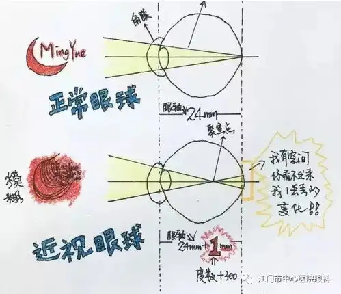 爸妈们注意,你做的这些事正在毁掉孩子的眼睛
