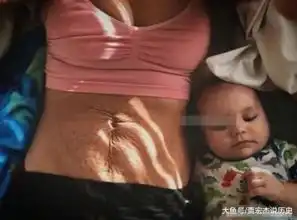 女子产后晒出恐怖妊娠纹,丑陋照片反获赞,网友不敢看

