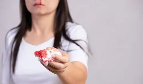 为何身上无缘无故出现淤青可能是身体的4个问题藏不住了
