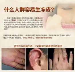 领券下单立减10元芊茗草冻疮膏冻伤膏止痒防冻防裂冬季护手足耳冻康宝滋润护手霜
