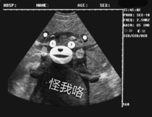 笑话段子我去医院检查结果真怀孕了,出来高兴的给老公电话手机
