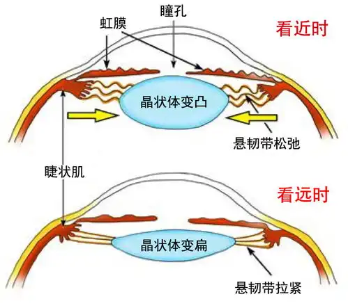 4岁孩子近视600多度,关于孩子近视一次说清
