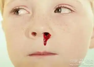 鼻子流血表情包宋民国