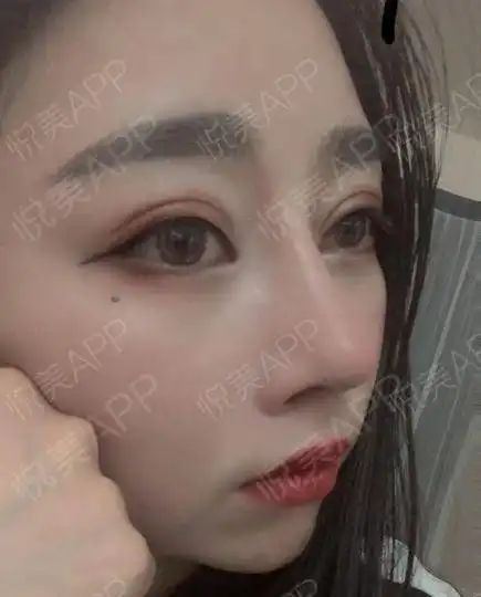 鼻子流血表情包针眼