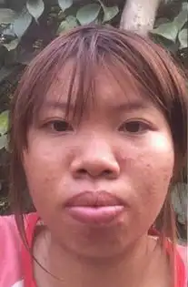 越南丑女相亲屡次被拒,花钱整容后判若两人,从此人生大逆转
