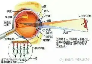 近视眼形成的原理
