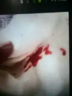 好心医生帮帮我我老婆这几天老咳嗽高烧三十八度五,今天下午咳的吐血了请问这是什么病我们该去哪里治疗
