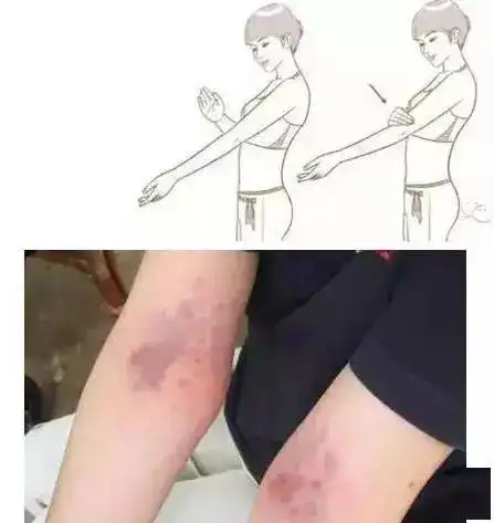 半夜34点钟清醒的人有救了把身体这处拍红,让你安睡一夜
