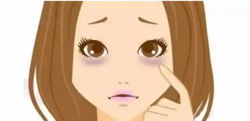 黑眼圈可能不仅仅是熬夜还与这4种疾病有关
