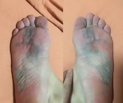 我想截肢前穿上这双鞋双十一爆笑买家秀你是要把我笑死,继承我的快递吗
