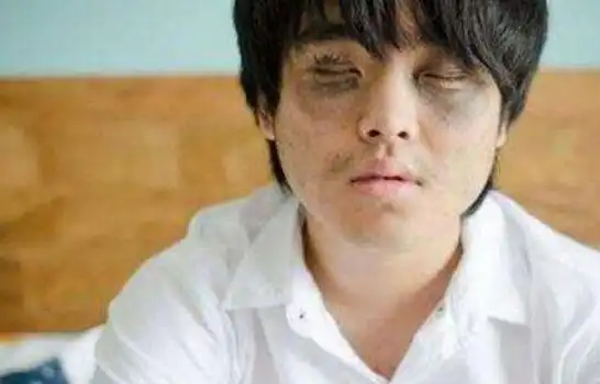 为什么现代人湿热很重

