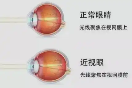 网上热议的恢复视力训练,到底靠不靠谱真相来了
