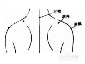 用按摩的方法来治疗落枕
