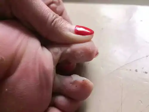 被针对的母瘊子
